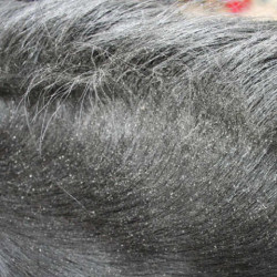 Animaderm Derfly Insektenschutz Animaderm Derfly Insektenschutz