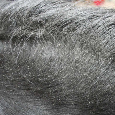 Animaderm Derfly Insektenschutz Animaderm Derfly Insektenschutz