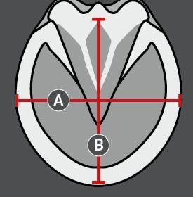 Abbildung der Größentabelle für Hufschuhe Pferd Equine Fusion